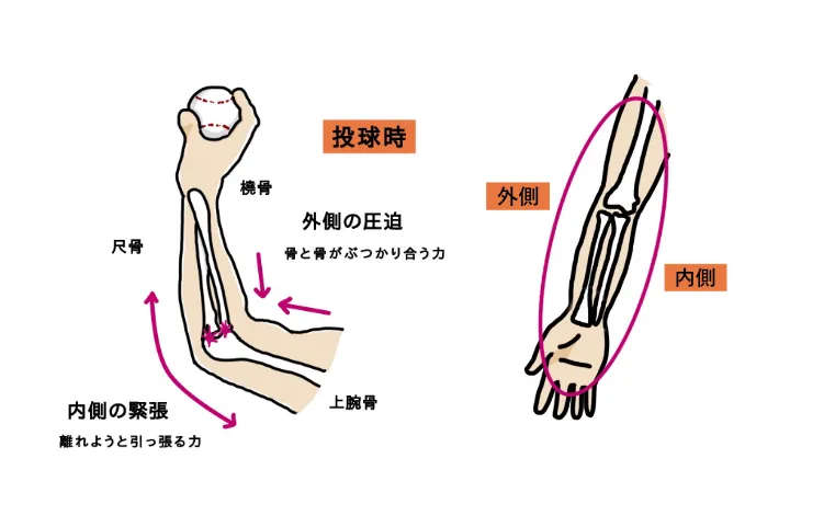 【稲沢市】野球選手必見！肘の痛みの原因と予防方法